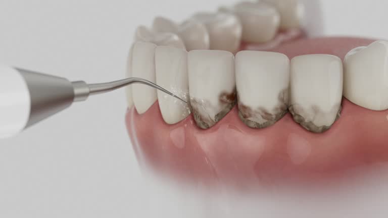 Trusted Teeth Cleaning And Checkup service in Bayboro, NC - Dentist Open Now